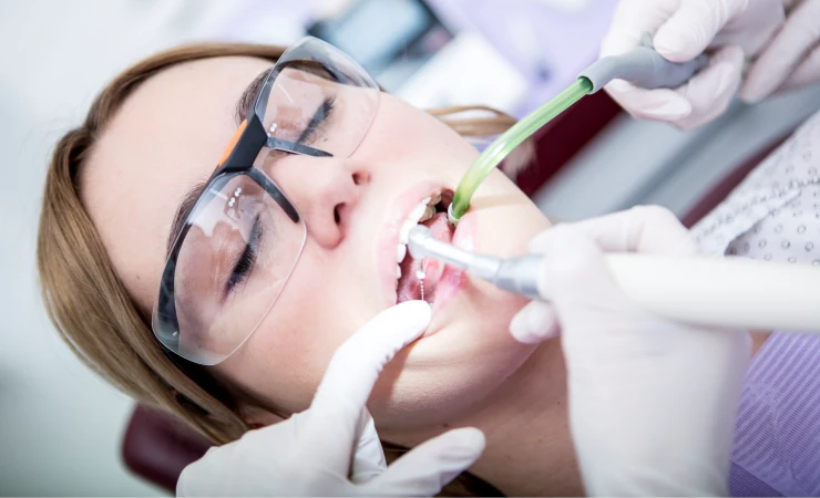How Long Do Root Canals Last
